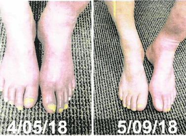 Tulsa light therapy clinic